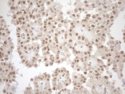 MGMT Antibody (OTI4F9), Novus Biologicals 0.1 mL | Buy Online | R&D Systems | Fisher Scientific