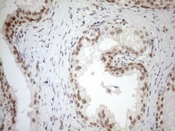 MGMT Antibody (OTI4F9), Novus Biologicals 0.1 mL | Buy Online | R&D Systems | Fisher Scientific
