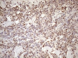 MGMT Antibody (OTI4F9), Novus Biologicals 0.1 mL | Buy Online | R&D Systems | Fisher Scientific