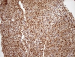 MGMT Antibody (OTI4F9), Novus Biologicals 0.1 mL | Buy Online | R&D Systems | Fisher Scientific
