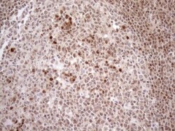 MGMT Antibody (OTI4F9), Novus Biologicals 0.1 mL | Buy Online | R&D Systems | Fisher Scientific