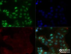 MGMT Antibody (MT 23.2) - BSA Free, Novus Biologicals:Antibodies:Primary