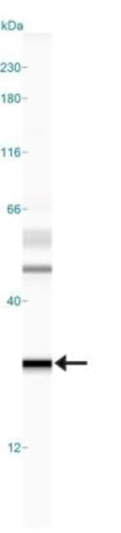 MGMT Antibody (MT 23.2) - BSA Free, Novus Biologicals:Antibodies:Primary
