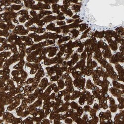 MGST2 Antibody, Novus Biologicals 0.1mL; Unlabeled:Antibodies, Polyclonal