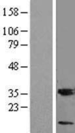 Novus Biologicals™ MGST3 Overexpression Lysate