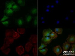 MHC Class I Antibody (OX18) - BSA Free, Novus Biologicals 0.025 mg, Unconjugated:Antibodies,