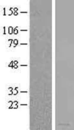 Novus Biologicals&trade;&nbsp;MIA Overexpression Lysate