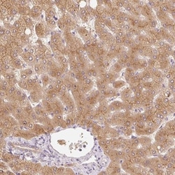 MIA2 Antibody, Novus Biologicals 0.1mL; Unlabeled:Antibodies, Polyclonal
