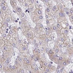 MIA3 Antibody, Novus Biologicals 0.1mL; Unlabeled:Antibodies, Polyclonal