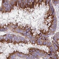 MIA3 Antibody, Novus Biologicals 0.1mL; Unlabeled:Antibodies, Polyclonal