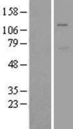 Novus Biologicals&trade;&nbsp;Mind Bomb 1/MIB1 Overexpression Lysate