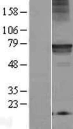Novus Biologicals Mic1 Overexpression Lysate 0.1 mg | Buy Online | Novus Biologicals&trade; | Fisher Scientific