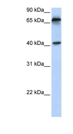 MICA Antibody, Novus Biologicals&trade;
