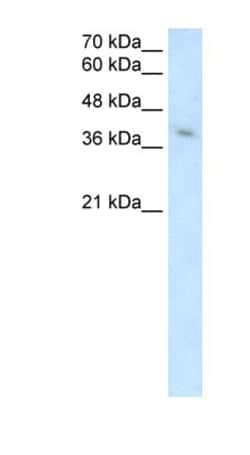 MICA Antibody, Novus Biologicals 100 &mu;L | Buy Online | Novus Biologicals | Fisher Scientific