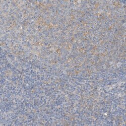 MICAL1 Antibody, Novus Biologicals 25 &mu;L, Unlabeled:Antibodies, Polyclonal