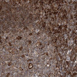 MICAL1 Antibody, Novus Biologicals 25 &mu;L, Unlabeled:Antibodies, Polyclonal