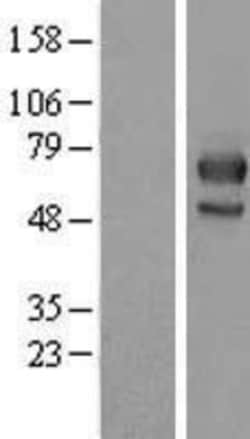 Novus Biologicals™ MID1 Overexpression Lysate