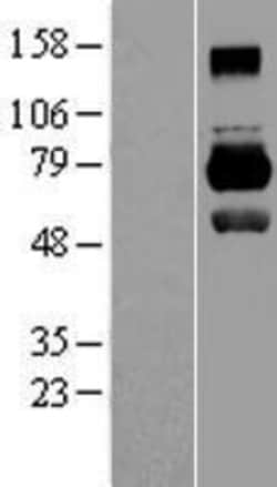 Novus Biologicals&trade;&nbsp;MID1 Overexpression Lysate