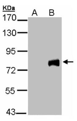 MID2 Antibody, Novus Biologicals 0.1mL; Unlabeled:Antibodies, Polyclonal