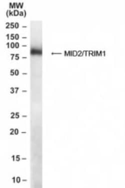 MID2 Antibody, Novus Biologicals 0.1mg; Unlabeled:Antibodies, Polyclonal