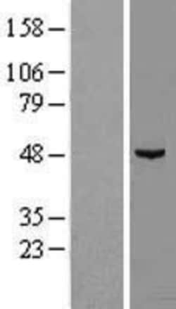 Novus Biologicals&trade;&nbsp;midA Overexpression Lysate