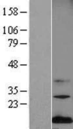 Novus Biologicals™ Midkine Overexpression Lysate
