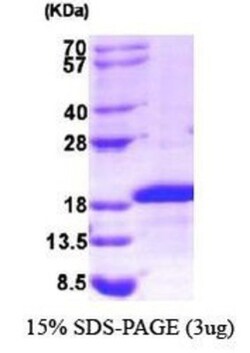 Novus Biologicals Recombinant Human Midkine His Protein 0.1mg | Buy Online | Novus Biologicals&trade; | Fisher Scientific