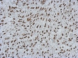 MIER3 Antibody, Novus Biologicals 0.1mL; Unlabeled:Antibodies, Polyclonal