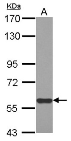 MIER3 Antibody, Novus Biologicals 0.1mL; Unlabeled:Antibodies, Polyclonal