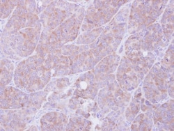 MIF Antibody, Novus Biologicals 0.1mg; Unlabeled:Antibodies, Polyclonal
