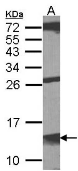 MIF Antibody, Novus Biologicals 0.1mg; Unlabeled:Antibodies, Polyclonal