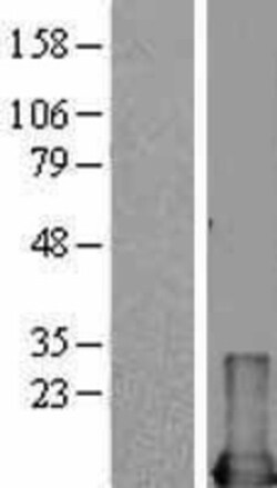 Novus Biologicals™ MIF Overexpression Lysate
