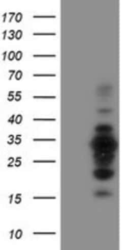 MIF4GD Antibody (OTI4C11), Novus Biologicals 0.1mL; Unlabeled:Antibodies,