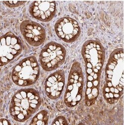 MIF4GD Antibody, Novus Biologicals 25 &mu;L, Unlabeled:Antibodies, Polyclonal