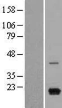 Novus Biologicals&trade;&nbsp;CXCL9/MIG Overexpression Lysate