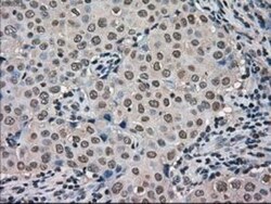 MIG2/Kindlin-2 Antibody (OTI9E4), Novus Biologicals 0.1mL; Unlabeled:Antibodies,