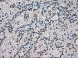 MIG2/Kindlin-2 Antibody (OTI9E4), Novus Biologicals 0.1mL; Unlabeled:Antibodies,