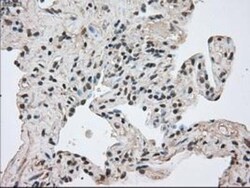 MIG2/Kindlin-2 Antibody (OTI9E4), Novus Biologicals 0.1mL; Unlabeled:Antibodies,