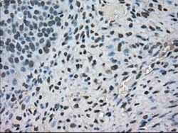 MIG2/Kindlin-2 Antibody (OTI9E4), Novus Biologicals 0.1mL; Unlabeled:Antibodies,