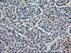 MIG2/Kindlin-2 Antibody (OTI9E4), Novus Biologicals 0.1mL; Unlabeled:Antibodies,