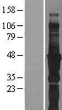 Novus Biologicals&trade;&nbsp;Migfilin Overexpression Lysate