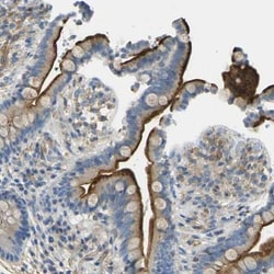 Mimecan/OIF Antibody, Novus Biologicals 25 &mu;L; Unlabeled:Antibodies,