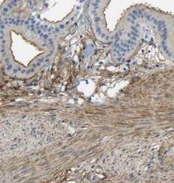 Mimecan/OIF Antibody, Novus Biologicals 25 &mu;L; Unlabeled:Antibodies,