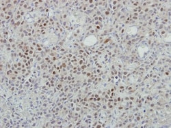 MINA Antibody, Novus Biologicals 0.1mL; Unlabeled:Antibodies, Polyclonal