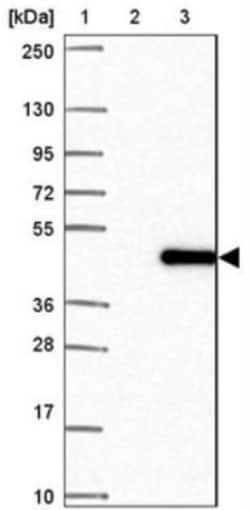 Mindin/Spondin-2 Antibody, Novus Biologicals 25 &mu;L, Unlabeled:Antibodies,