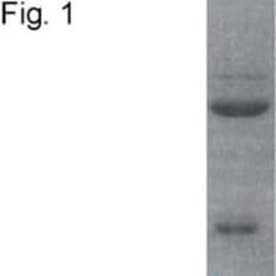 Mineralocorticoid R/NR3C2 Antibody (H10E4C9F) - BSA Free, Novus Biologicals