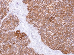 MINPP1 Antibody, Novus Biologicals 0.1mg; Unlabeled:Antibodies, Polyclonal