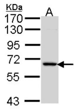 MINPP1 Antibody, Novus Biologicals 0.1mg; Unlabeled:Antibodies, Polyclonal