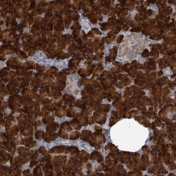 MINPP1 Antibody, Novus Biologicals 0.1mL; Unlabeled:Antibodies, Polyclonal