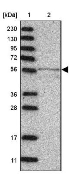 MINPP1 Antibody, Novus Biologicals 0.1mL; Unlabeled:Antibodies, Polyclonal